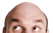 O que Fazer para não Ficar Careca – Saiba como Prevenir a Calvície
