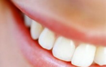 Clareamento Dental – Conheça os Benefícios e os Riscos do Tratamento