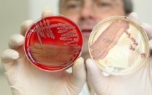 Médicos Já têm Tratamento para Nova Bactéria Escherichia coli – Veja