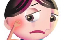 Alergias: O que São, Causa, Tratamento, Tipos de Alergias e muito mais
