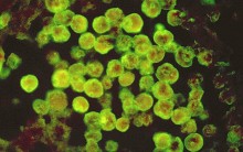 Ameba Naegleria fowleri Devora Cérebro Humano: EUA tem 3 Casos Fatais