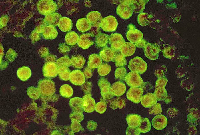 Ameba Naegleria fowleri Devora Cérebro Humano: EUA tem 3 Casos Fatais