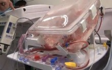 Caixa Mantém Coração Batendo fora do Corpo Humano, Transporte de Órgão