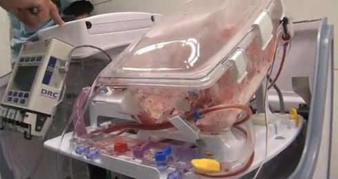 Caixa Mantém Coração Batendo fora do Corpo Humano, Transporte de Órgão