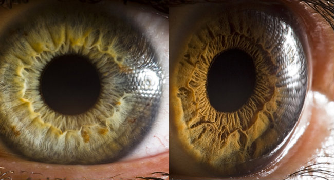Fotógrafo Suren Manvelyan Tira Fotos de Olhos de Pessoas e Animais