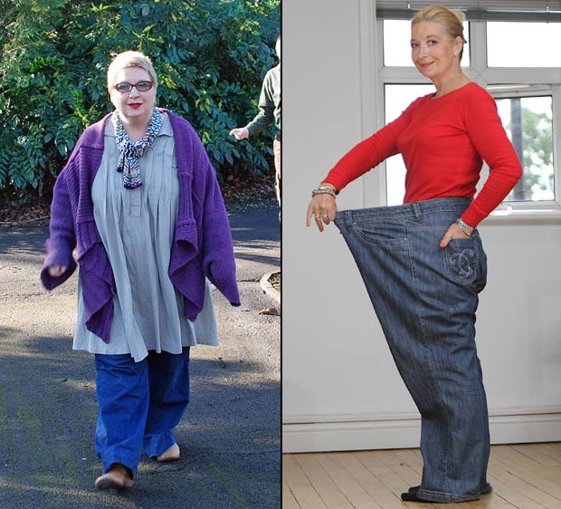 Emma Boronat, britânica de 39 anos Perde 70 Kilos Para Não Morrer Cedo