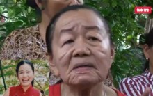 Jovem de 26 anos tem Reação Alérgica fica com Aspecto de Velha 70 Anos