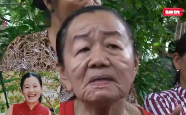 Jovem de 26 anos tem Reação Alérgica fica com Aspecto de Velha 70 Anos