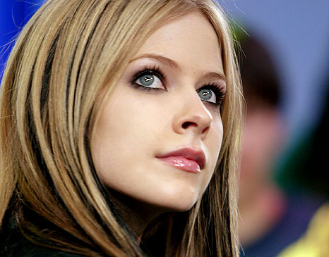 Cantora Avril Lavigne Briga, é Agredida, Fotos do seu Rosto Machucado