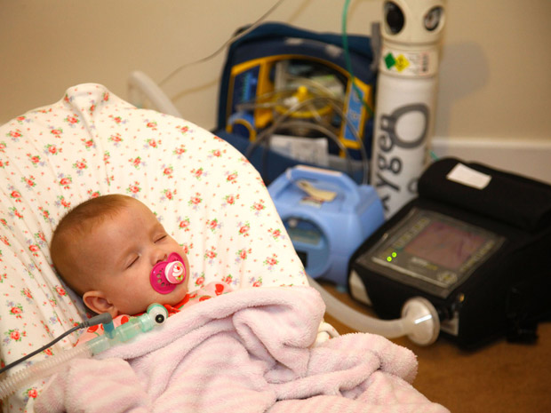 Bebê Inglês para de Respirar enquanto Dorme: Jovie Wyse e sua Doença