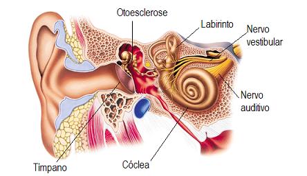 Otosclerose: Entenda o que é, Sinais, Sintomas, Tratamento, Aparelho