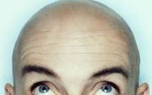 Tatuagem na Careca que Imita Cabelo: Como Disfarçar Calvicie Vantagens