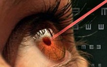 Cirurgia a Laser de Correção de Grau: Como parar de Usar Óculos, Dicas