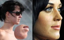 Defeitos das Celebridades: Imperfeições Físicas dos Famosos, Fotos