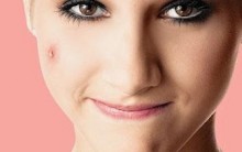 Como dar fim às Cicatrizes de Acnes: Laser CO2 Fracionado