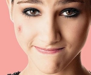 cicatrizes-de-acne-como-tirar-