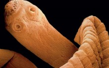 Teníase e Cisticercose: Doenças Tênia, Profilaxia, Tratamento e Tabela