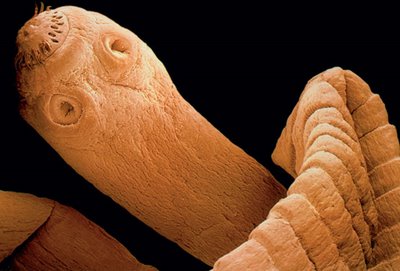 Teníase e Cisticercose: Doenças Tênia, Profilaxia, Tratamento e Tabela