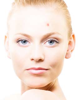Espinhas Como Tratar: Causas da Acne, Tratamento, Higienização da Pele
