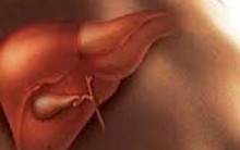Esteatose Hepática: Causa, Diagnóstico, Sintomas, Cuidados, Cura