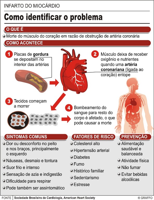 Infart0-miocardio