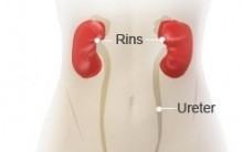 Infecção Urinária Constante, de Repetição, Como Cuidar, Evitar
