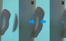 Orelha de Abano: Cirurgia Plástica Otoplastia, Cuidados, Preço, Idade