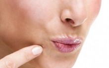 Pele limpa sem Acne, Espinhas: Dicas de Cuidados com a pele do Rosto