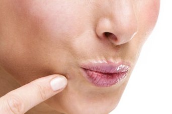 Pele limpa sem Acne, Espinhas: Dicas de Cuidados com a pele do Rosto