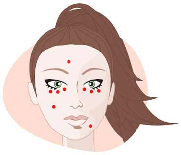 Acne – Dicas Esconder Espinhas, Vídeo Jovem Chinesa com Passo a Passo