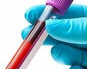 Jejum para Exames de Sangue – Horas Sem Comer em Coleta, Recomendações