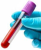 Jejum para Exames de Sangue – Horas Sem Comer em Coleta, Recomendações