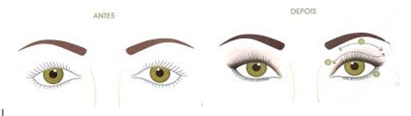 Como Disfarçar Olhos Caídos com Maquiagem, Dicas Corrigir Imperfeições