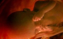 Cirurgia Fetal – Como se Inscrever SUS, Informações mais Você 19/03/14