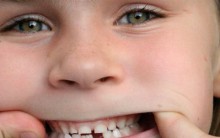 Tratamento Dentário Gratuito – Projeto Oferece Dentista Grátis Para Jovens, Site para Informações