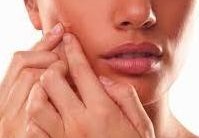 Mitos e Verdades sobre Acne – Cuidados e Cremes indicados