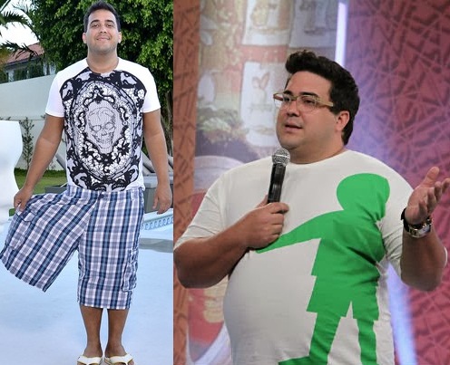 andré-marquês-antes-e-depois-de-emagrecer-cirurgia-
