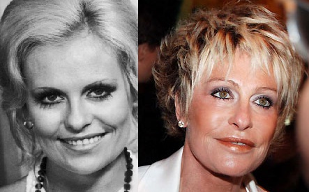 antes-e-depois-famosos-apresentadora-ana-maria-braga-