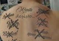 Creme para Retirar Tatuagem sem Dor – Como Funciona