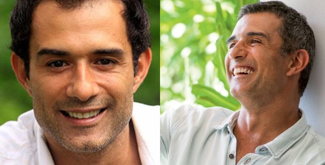 Transplante Capilar do Marcos Pasquim – Tudo Sobre