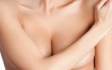 Mama Acessória ou Axilar Que é, Sintomas, Tratamento, Cirurgia