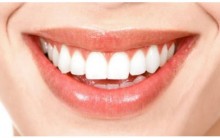 Como Clarear os Dentes – Dicas Caseiras  de Beleza