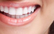 Causas dos Dentes Manchados – Dicas de Tratamento e Prevenção das Manchas nos Dentes