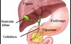 Inflamação da Vesícula – Remédios Caseiros e Chás para Tratar a Colecistite