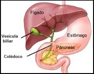 Inflamação da Vesícula – Remédios Caseiros e Chás para Tratar a Colecistite