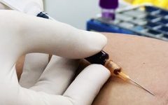 Biópsia Líquida – Exame de Sangue Detecta Câncer na Fase Inicial Afirma Estudos