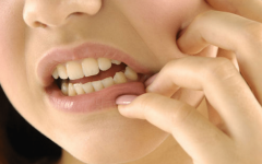 Retirada do Dente do Siso: Como É, Pós-operatório, O que Comer e Remédios
