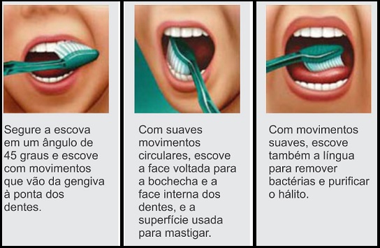 Causas do Mau Hálito Crônico – Dicas de Tratamento e Higiene Bucal contra a Halitose