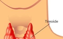 Sintomas do Hipertireoidismo – Disfunção da Tireoide, Causas e Tratamento