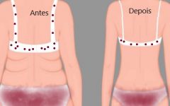 Exercícios Físicos para queimar gordura nas Costas Como Eliminar Pneus